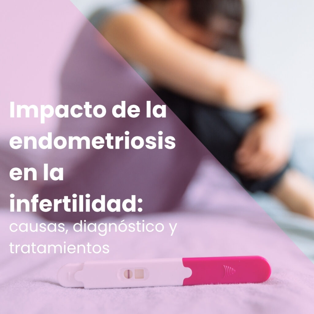 Impacto de la endometriosis en la infertilidad: causas, diagnóstico y tratamientos