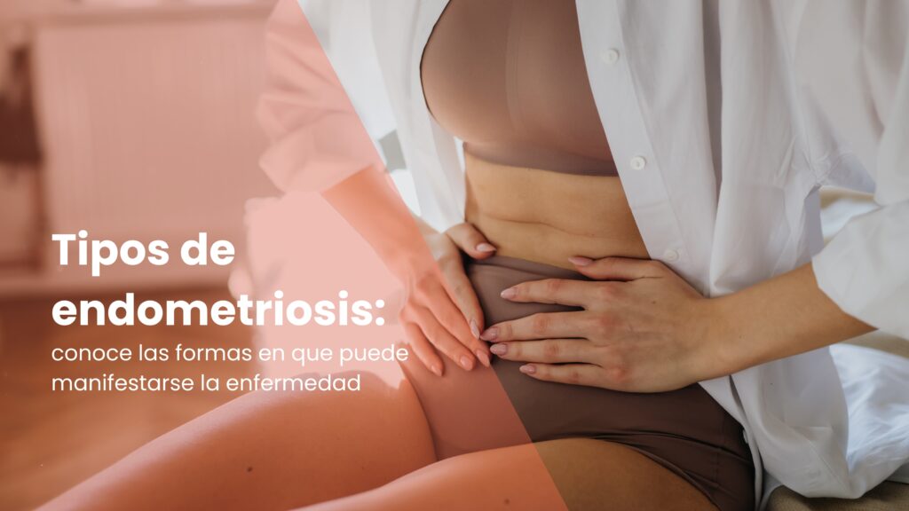 Tipos de endometriosis
