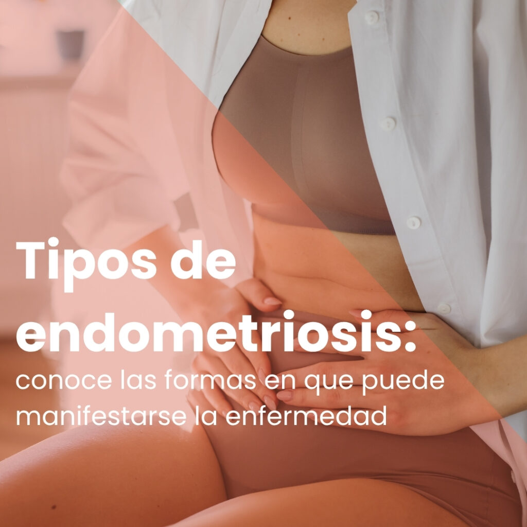 Tipos de endometriosis