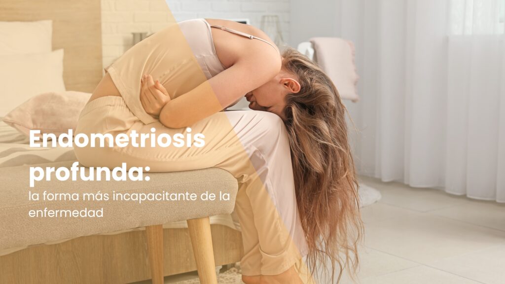 Endometriosis profunda: la forma más incapacitante de la enfermedad