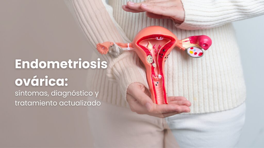 Endometriosis ovárica