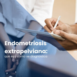 Endometriosis extrapelviana