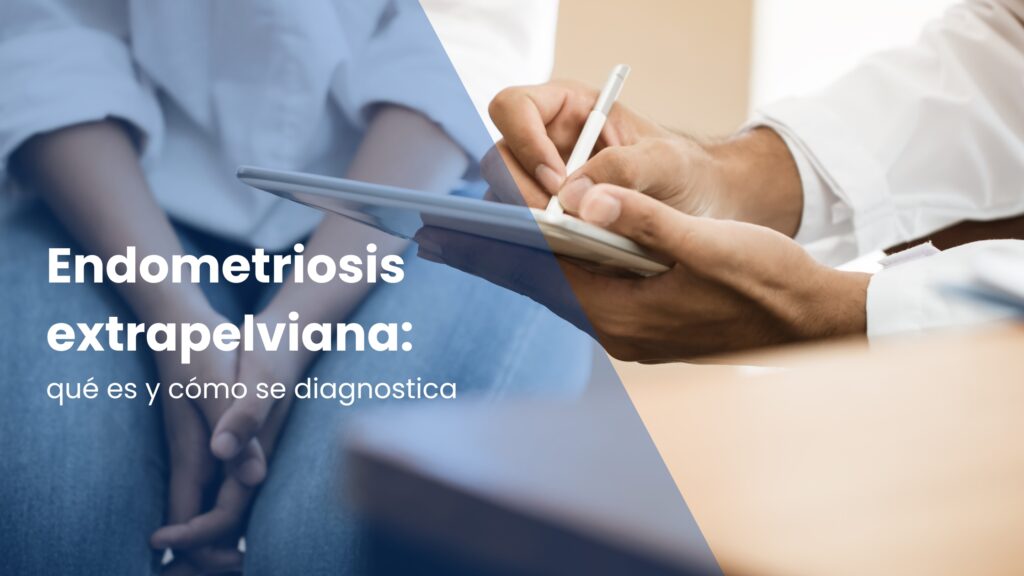 Endometriosis extrapelviana