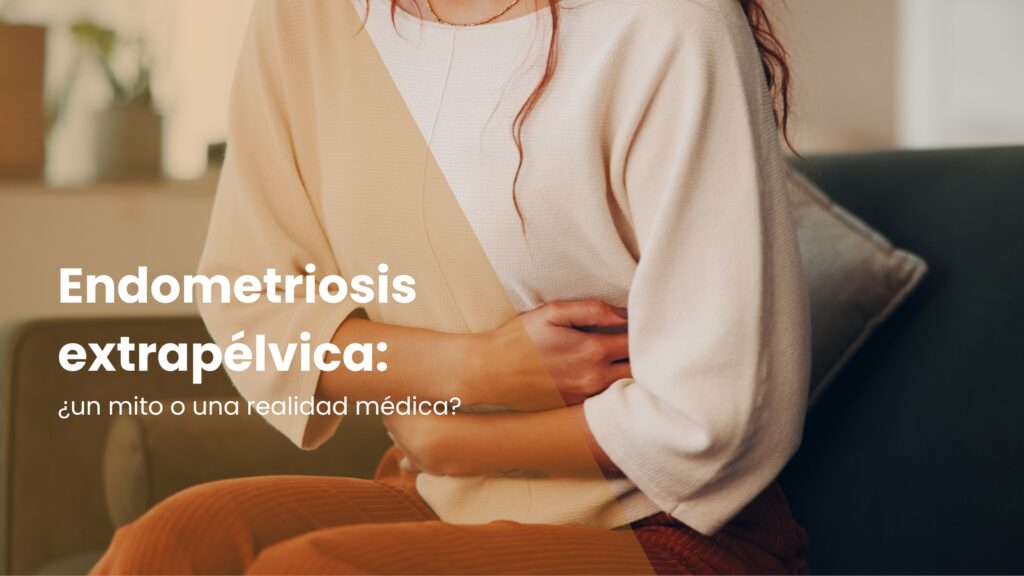 Endometriosis extrapélvica: