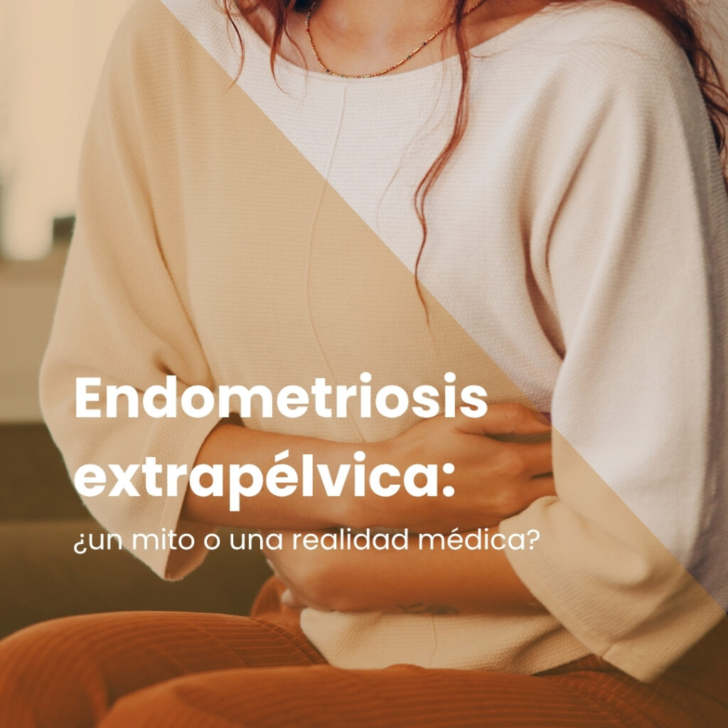 Endometriosis extrapélvica: