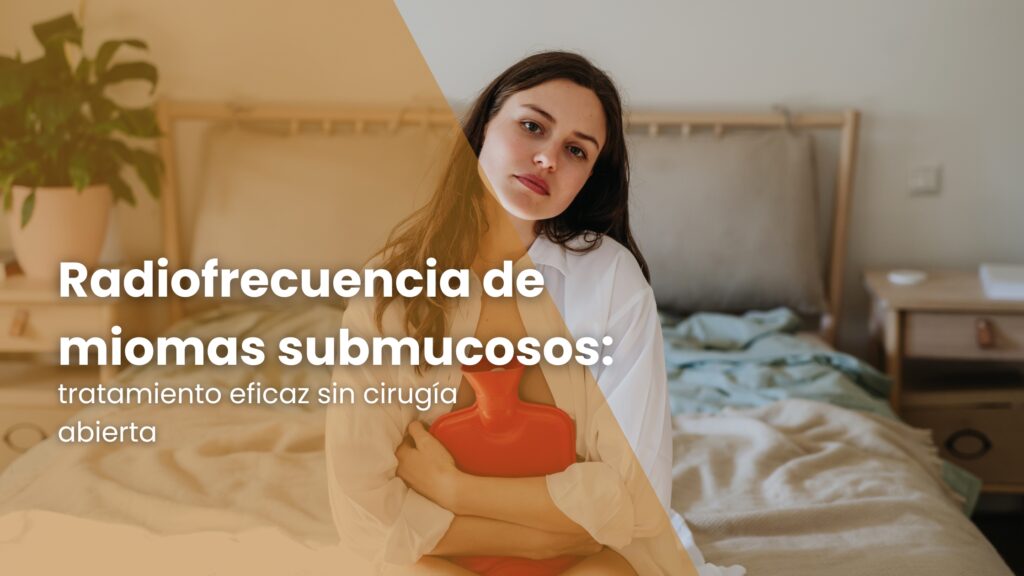 Radiofrecuencia de miomas submucosos: