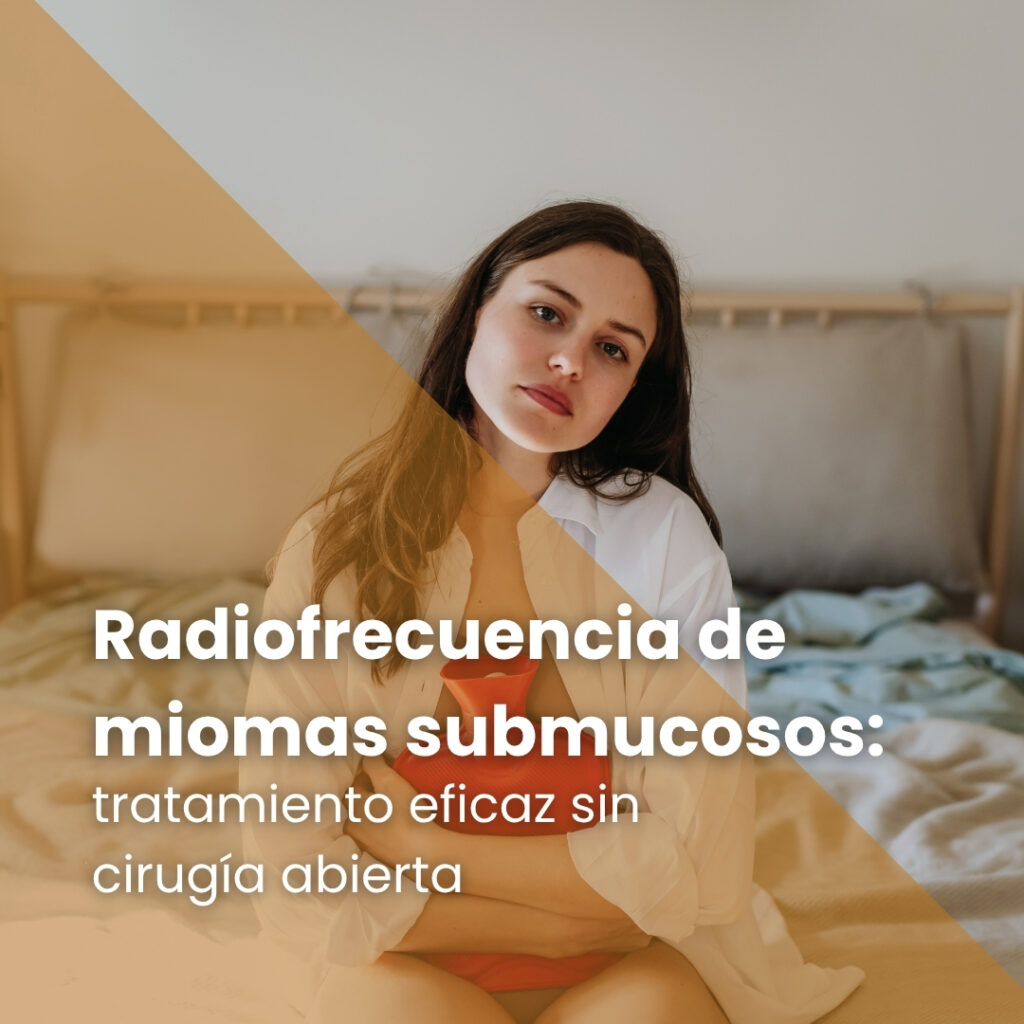 Radiofrecuencia de miomas submucosos: