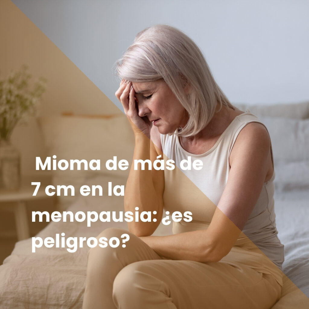 Mioma de más de 7 cm en la menopausia: ¿es peligroso?