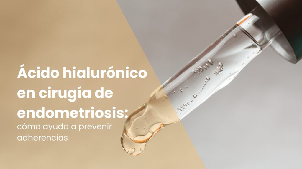 Ácido hialurónico en cirugía de endometriosis: cómo ayuda a prevenir adherencias