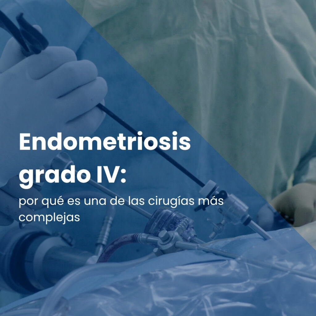 Endometriosis grado IV