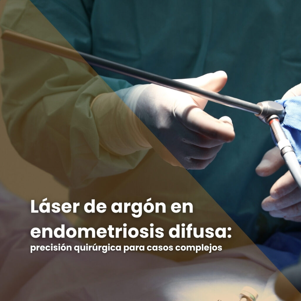 Láser de argón en endometriosis difusa
