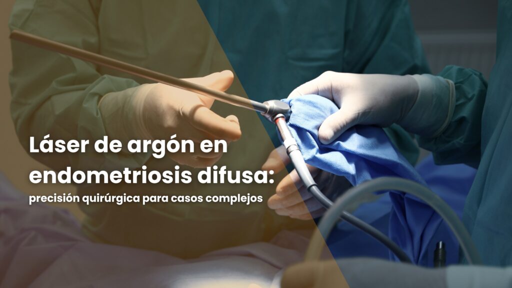 Láser de argón en endometriosis difusa
