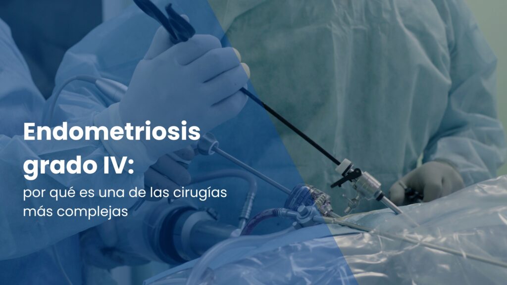 Endometriosis grado IV