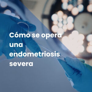 Cómo se opera una endometriosis severa