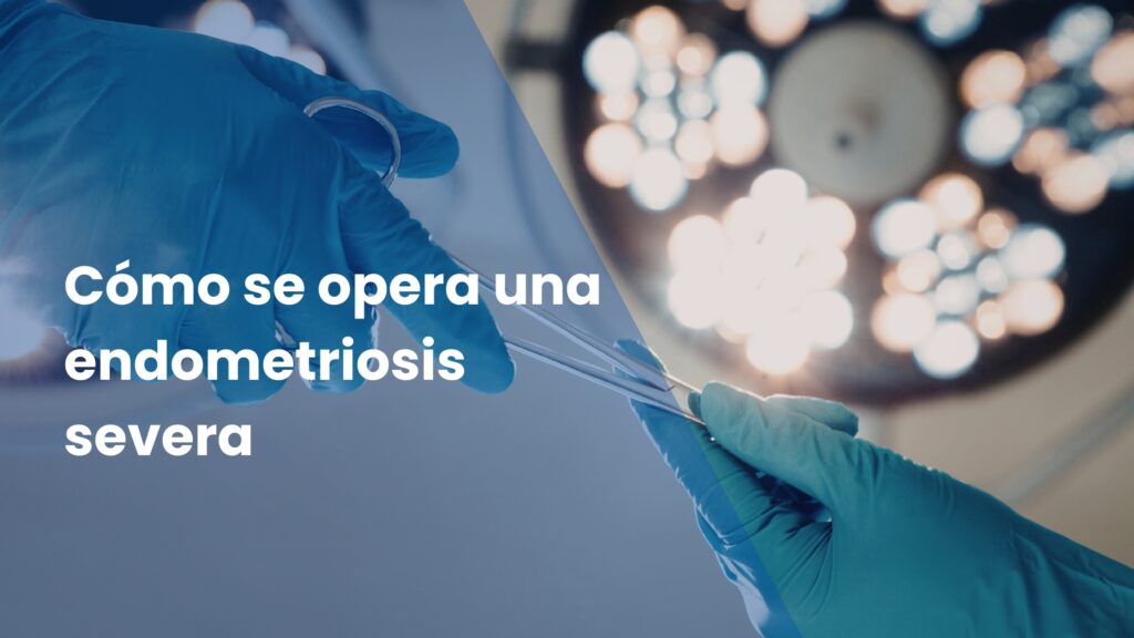 Cómo se opera una endometriosis severa