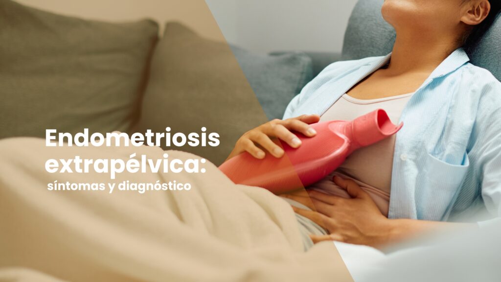 Endometriosis extrapélvica: