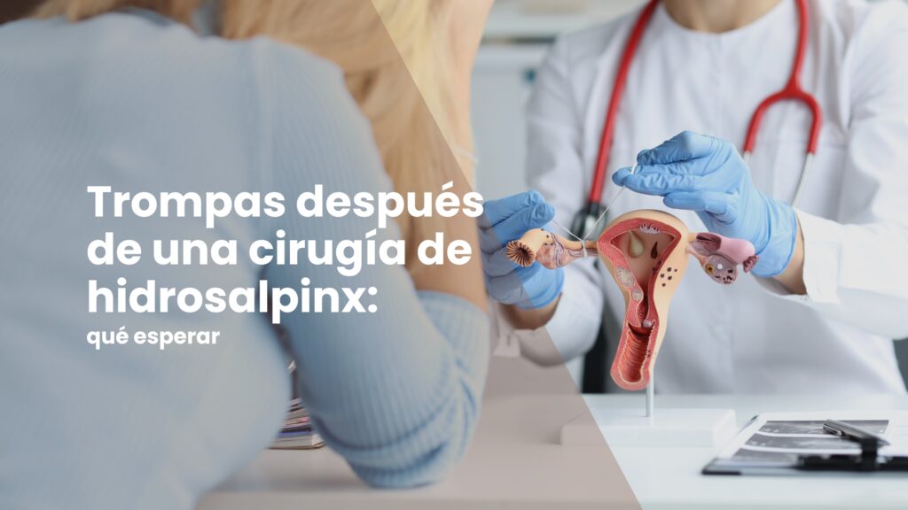 Trompas después de una cirugía de hidrosalpinx