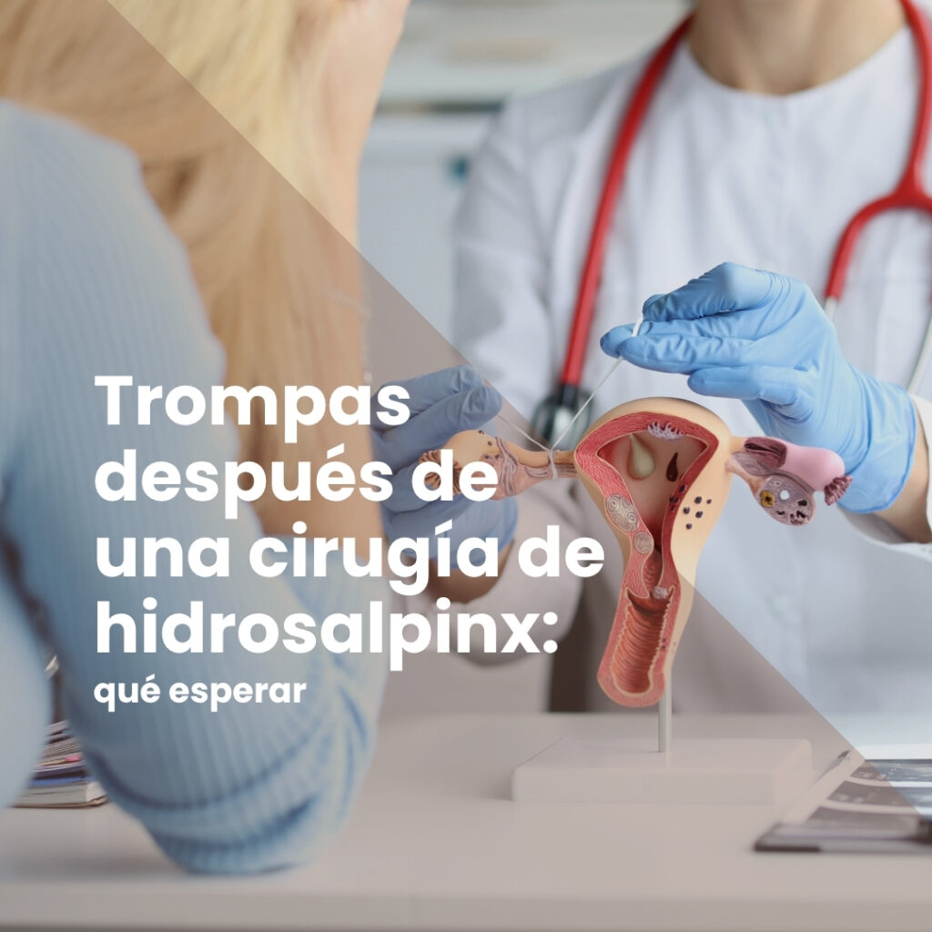 Trompas después de una cirugía de hidrosalpinx