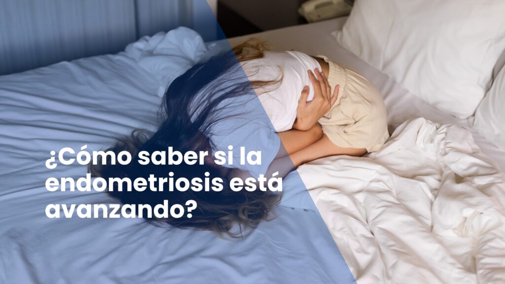 ¿Cómo saber si la endometriosis está avanzando?