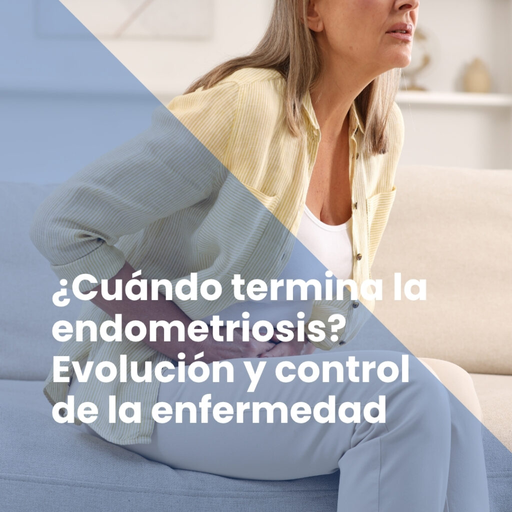 ¿Cuándo termina la endometriosis? Evolución y control de la enfermedad