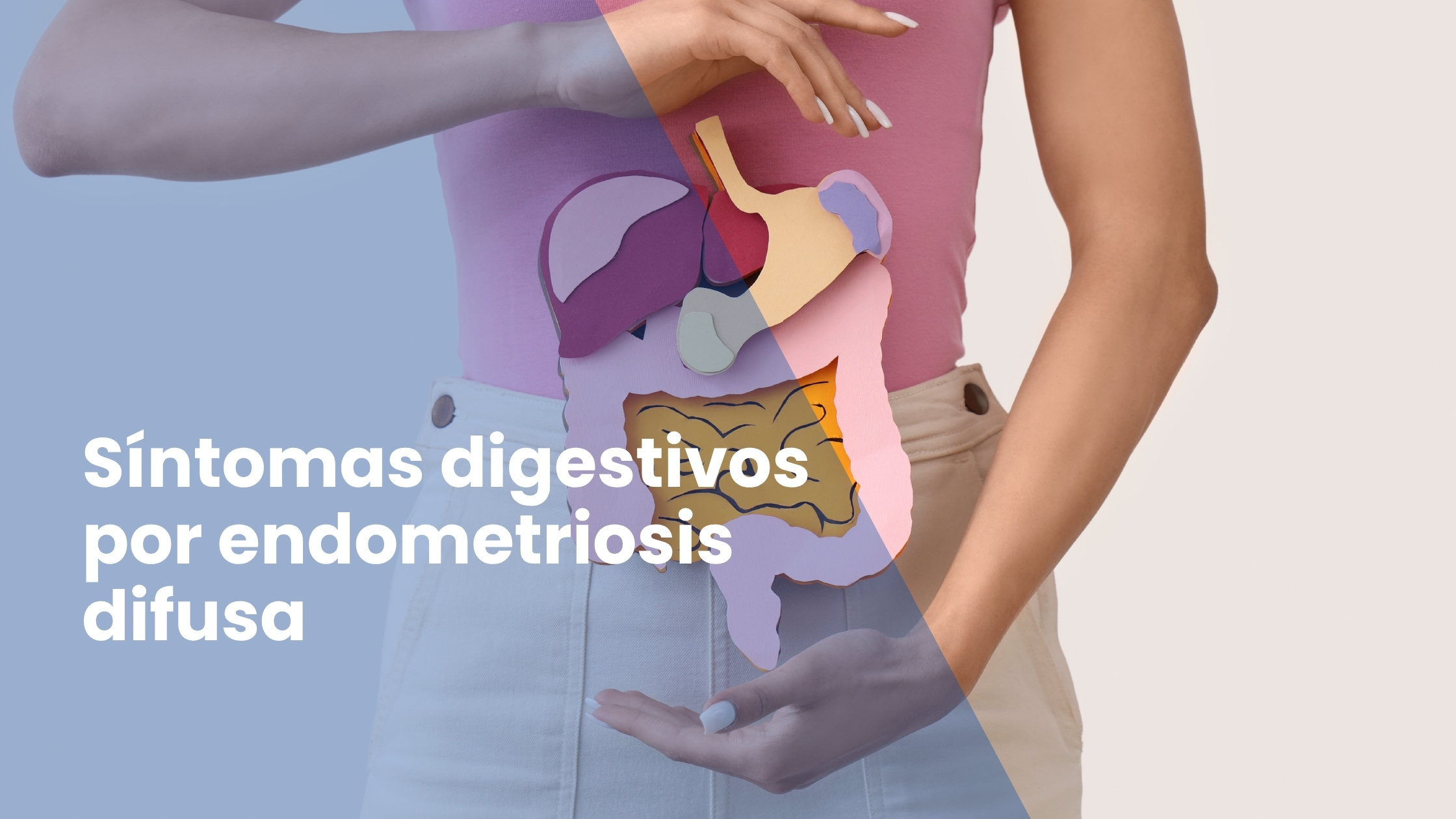 Síntomas digestivos por endometriosis difusa
