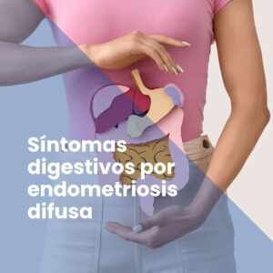 Síntomas digestivos por endometriosis difusa
