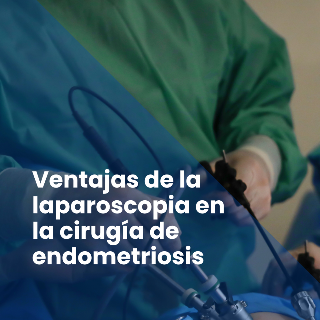 Ventajas de la laparoscopia en la cirugía de endometriosis