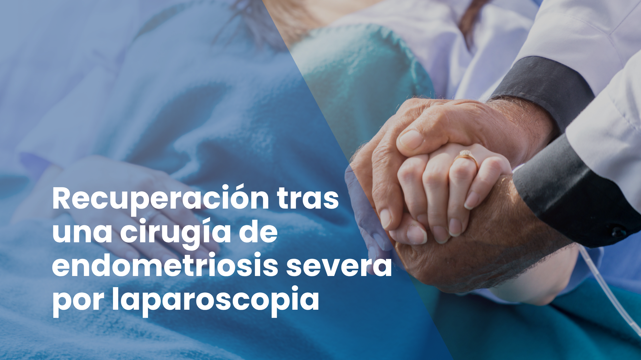 Recuperación tras una cirugía de endometriosis severa por laparoscopia